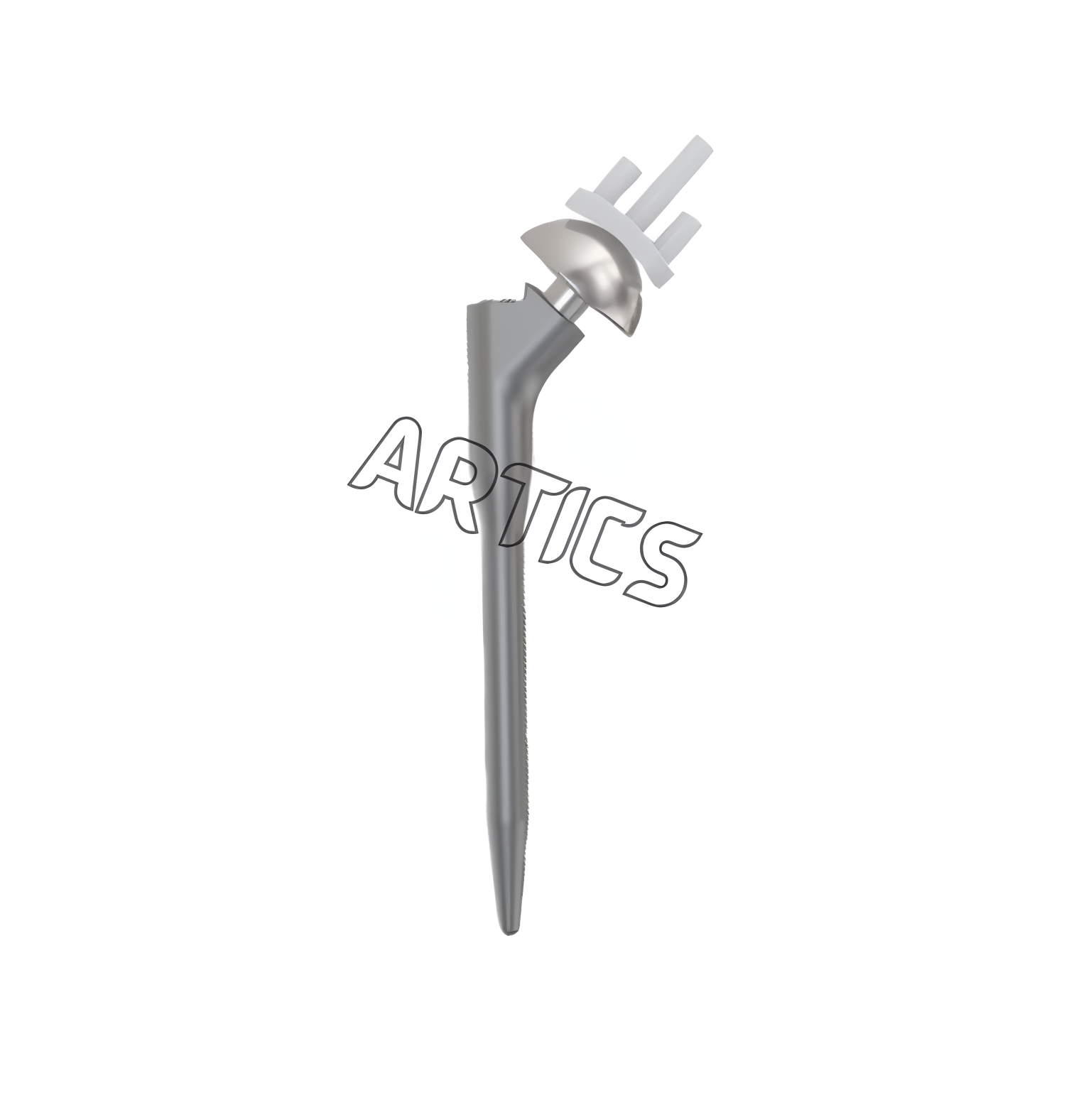 Anatomic Shoulder Replacement